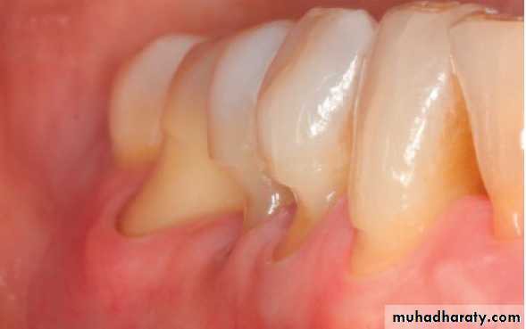 Clinical Periodontology