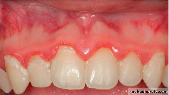 Clinical Periodontology