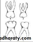 Morphology of Deciduous teeth