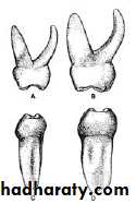 Morphology of Deciduous teeth