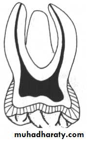 Morphology of Deciduous teeth