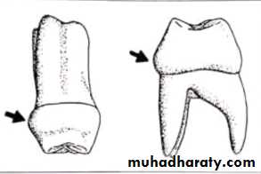Morphology of Deciduous teeth
