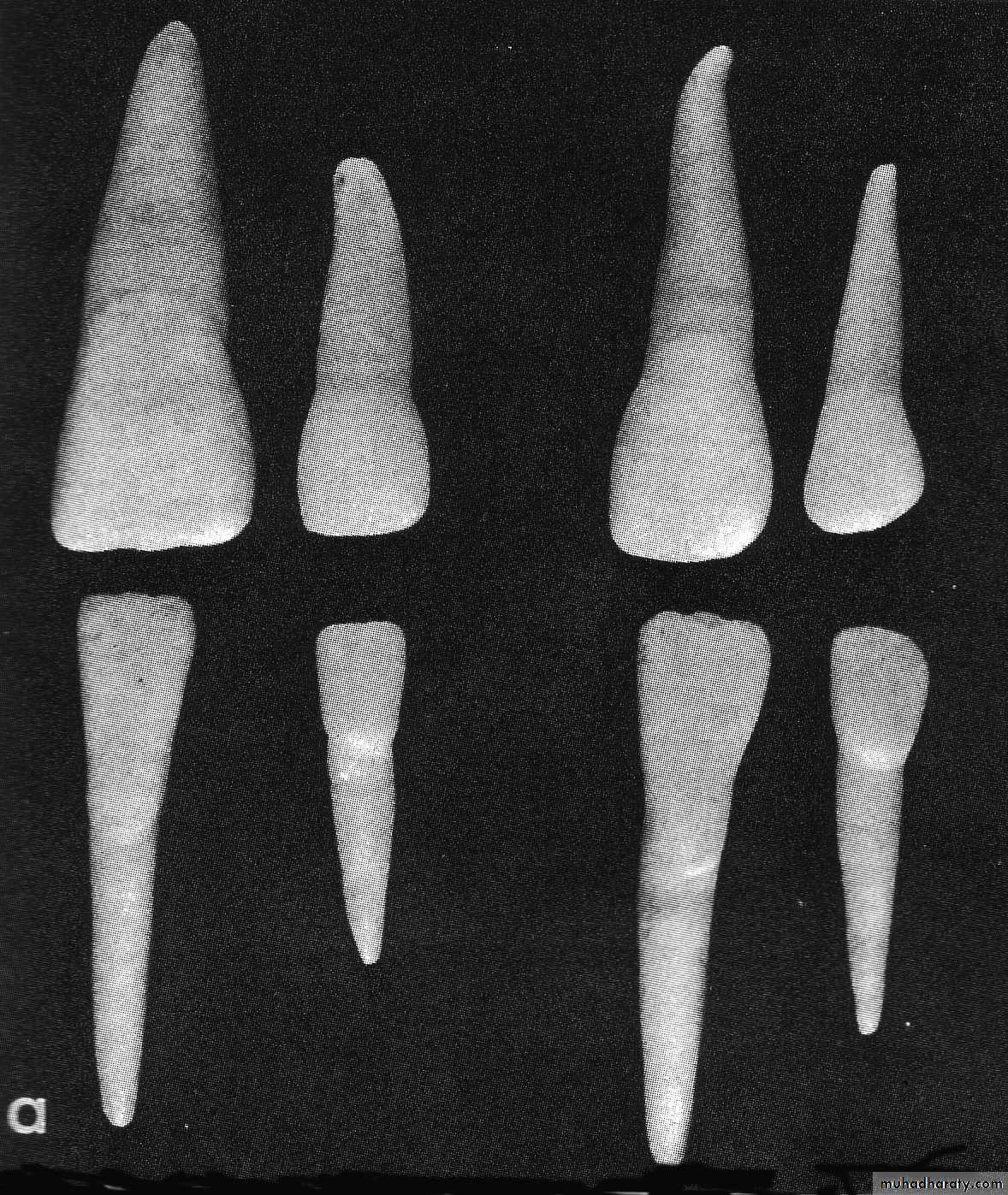 Morphology of Deciduous teeth