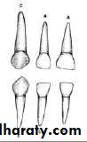 Morphology of Deciduous teeth