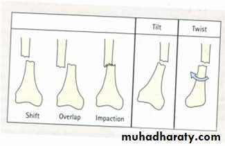 Introduction to Fractures