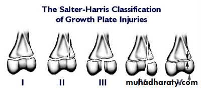Introduction to Fractures