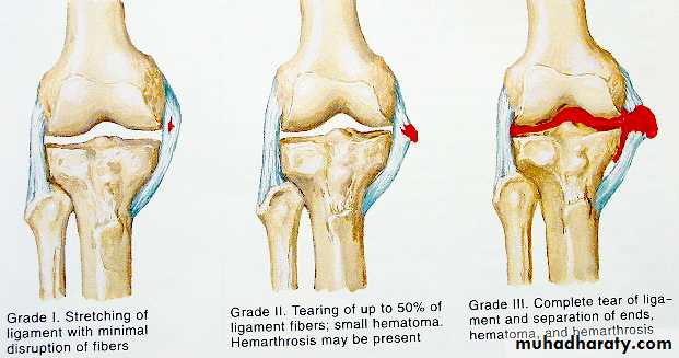 Introduction to Fractures