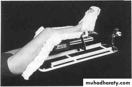 Management of Fractures