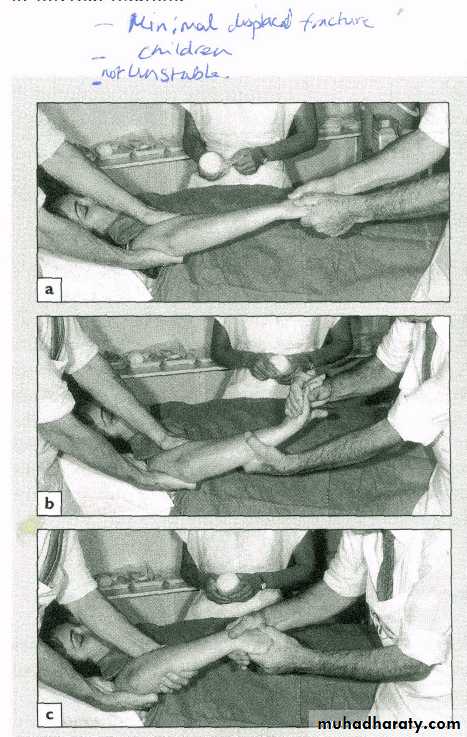 Management of Fractures