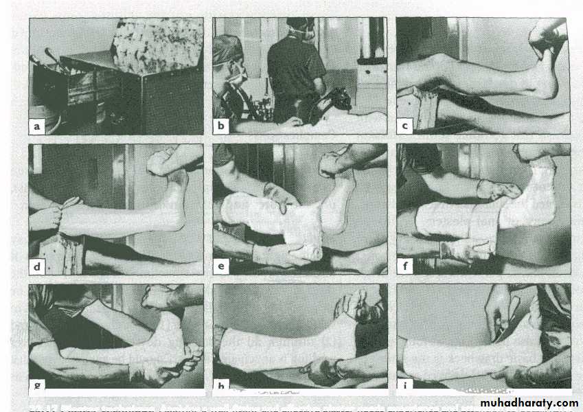 Management of Fractures