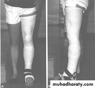 Management of Fractures