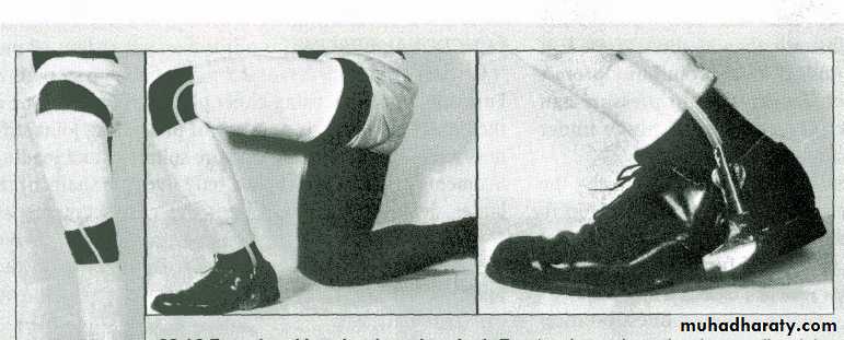 Management of Fractures