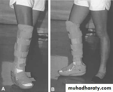 Management of Fractures