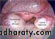 Soft tissue masses