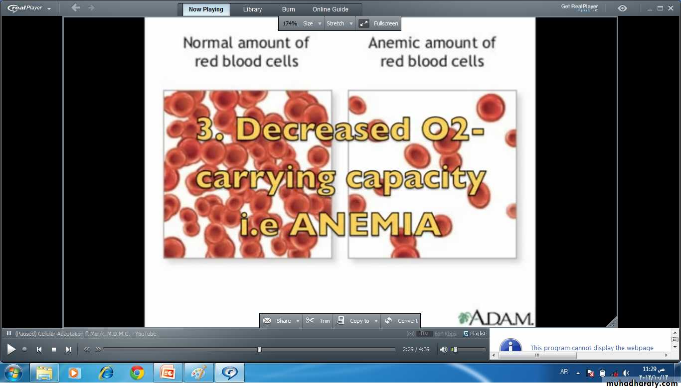 Cell Injury