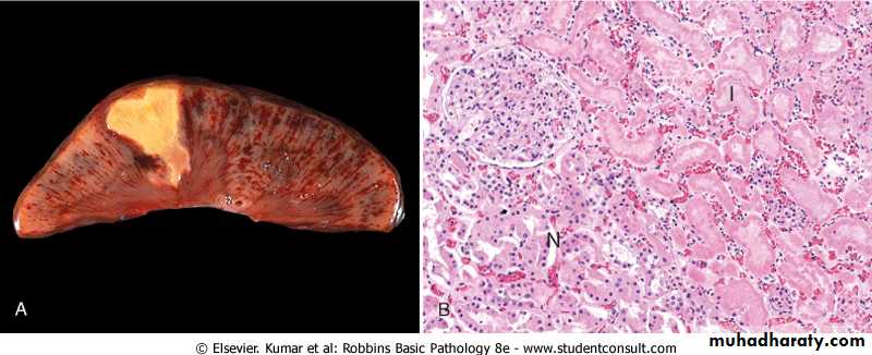Cell Injury