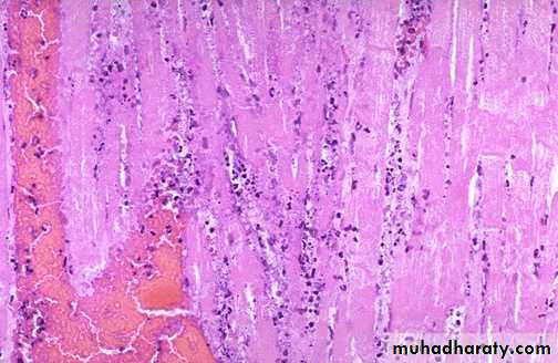 Cell Injury