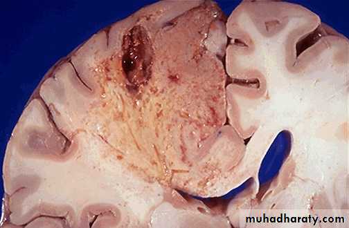 Cell Injury