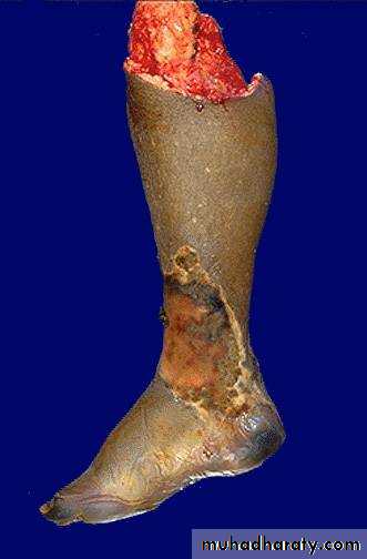 Cell Injury