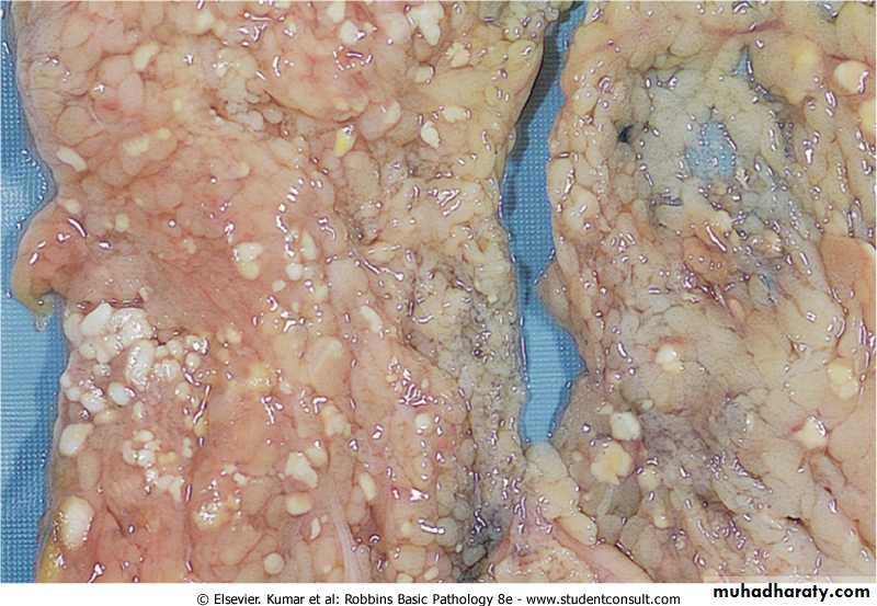 Cell Injury
