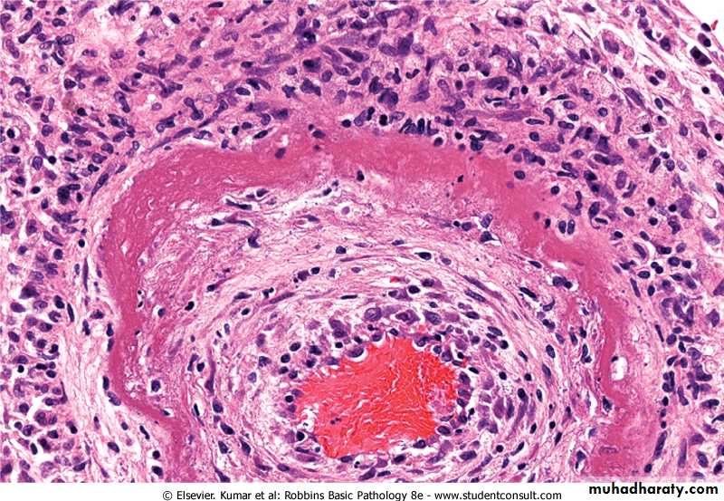 Cell Injury