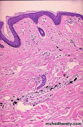 Cell Injury