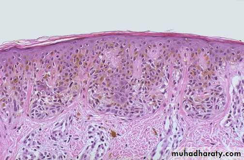 Cell Injury