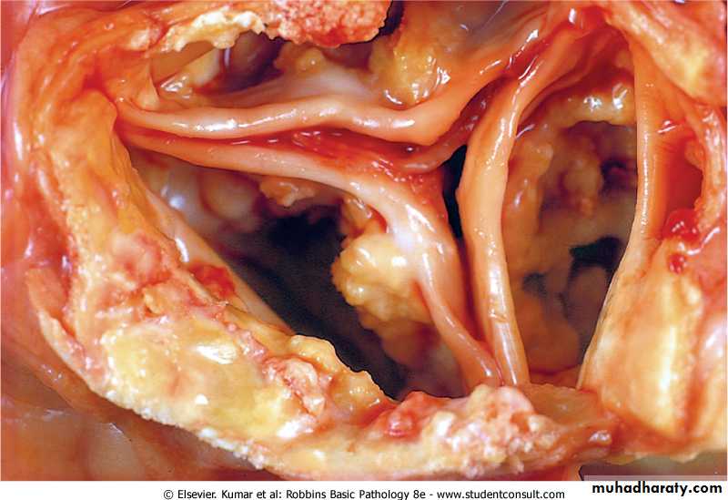 Cell Injury