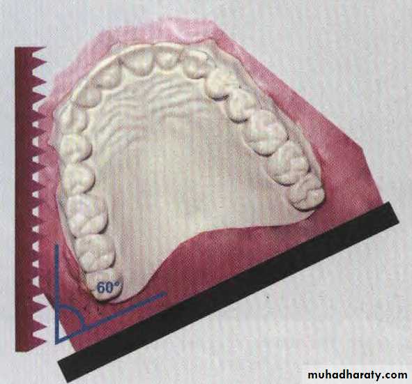 Study model