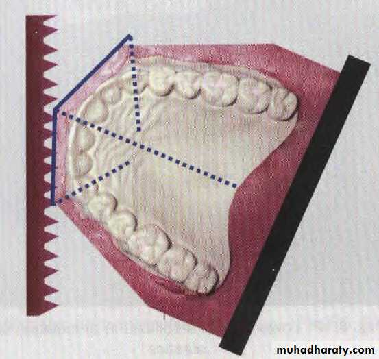 Study model