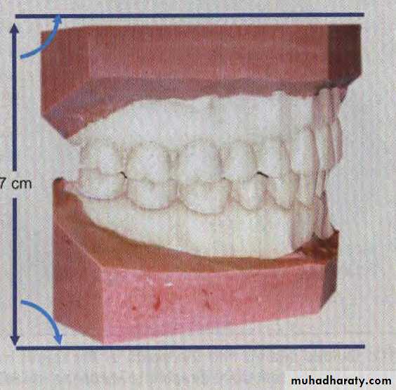 Study model