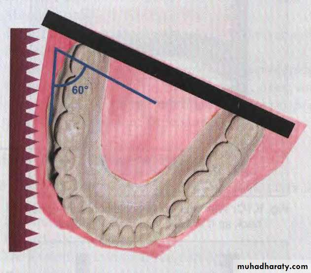Study model