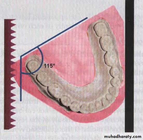 Study model