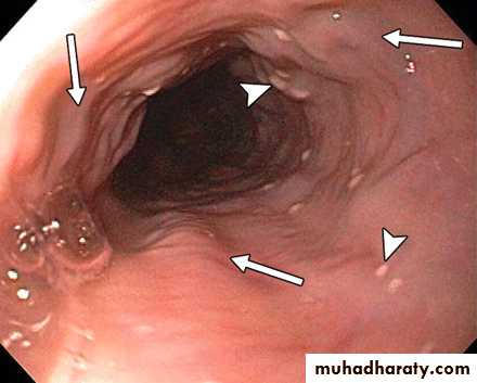 Artery Supply of the GUT