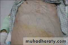 Artery Supply of the GUT