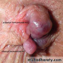 Artery Supply of the GUT
