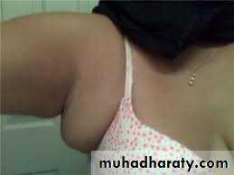 Breast