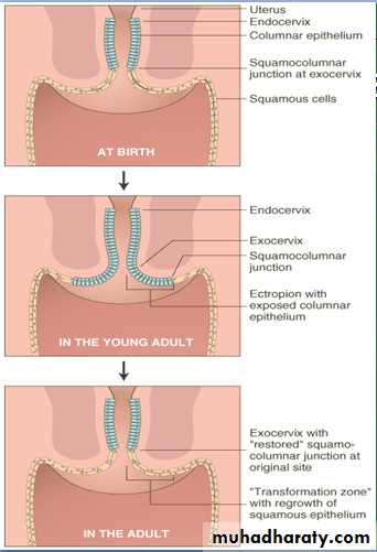 Premalignant condition of the cervix