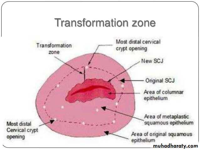Premalignant condition of the cervix