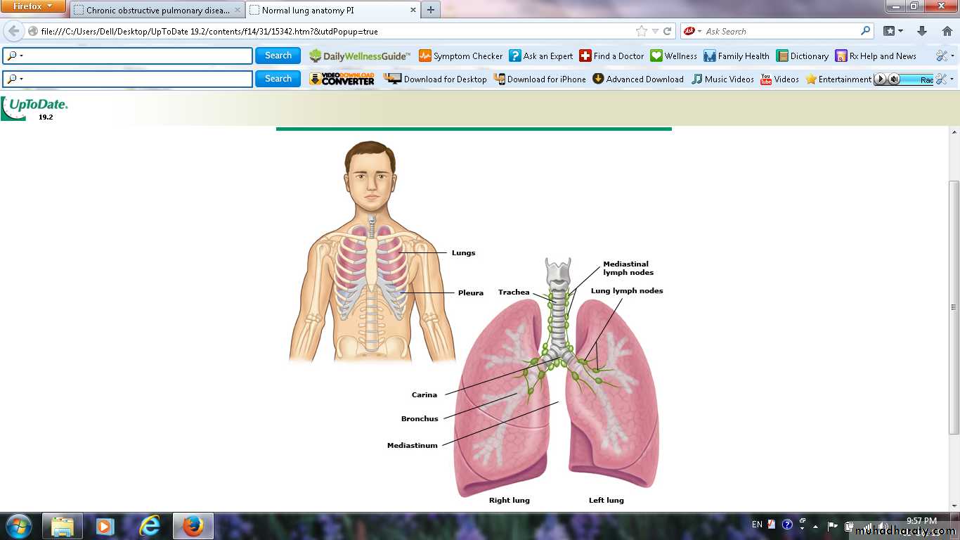 COPD