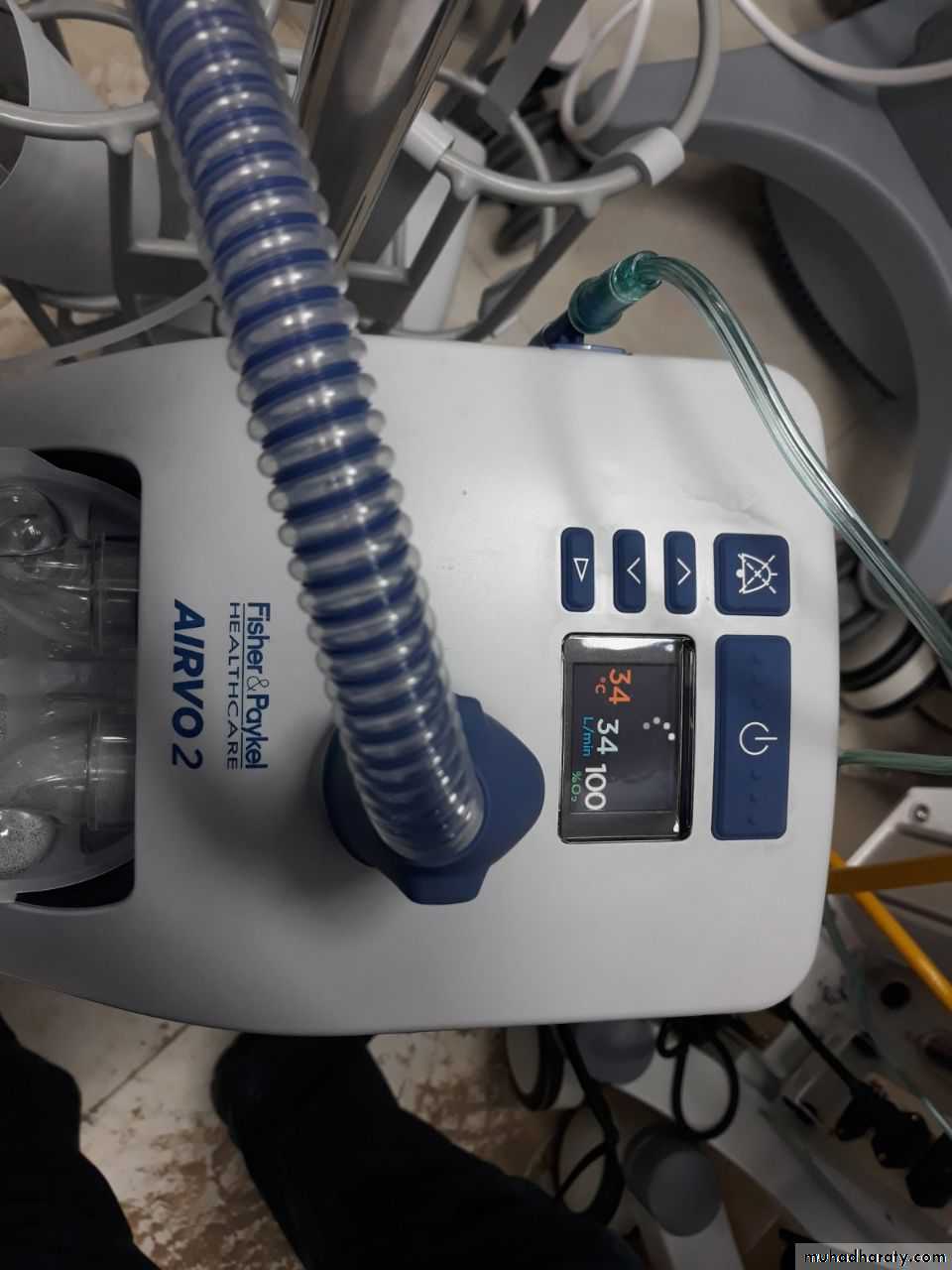 COPD