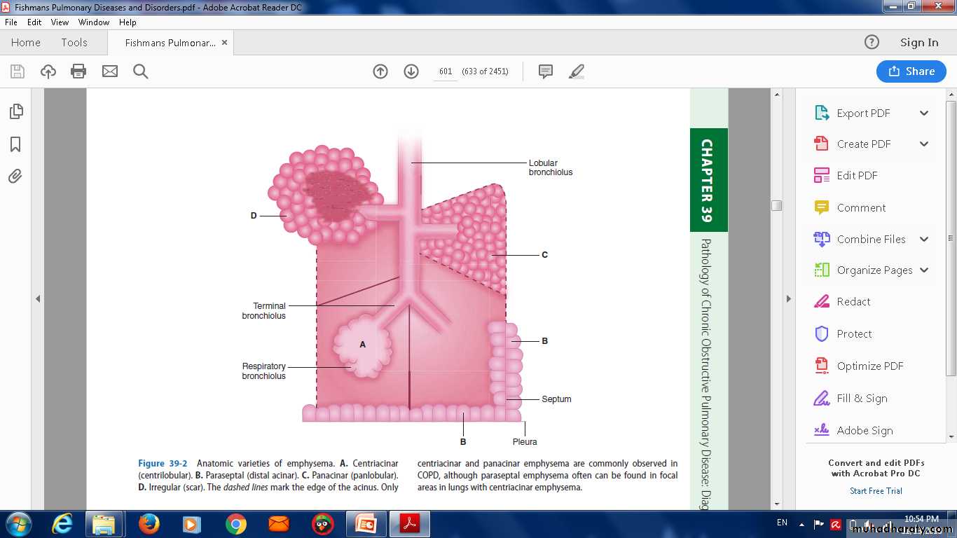 COPD