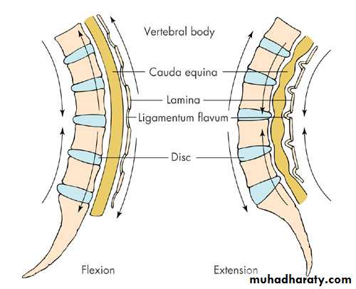 Back Pain