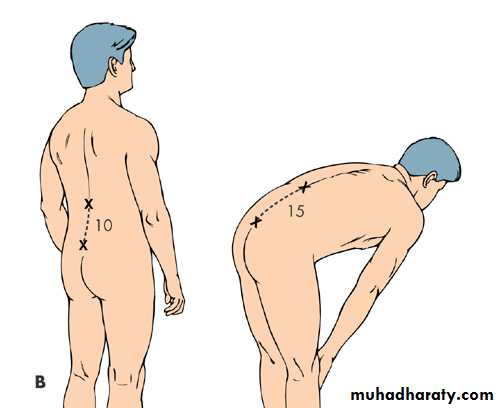 Back Pain
