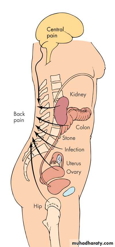 Back Pain