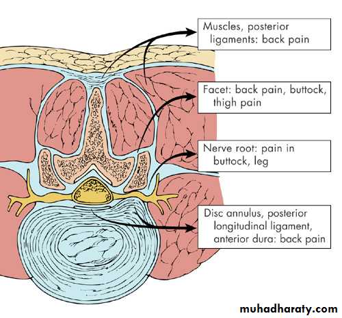 Back Pain