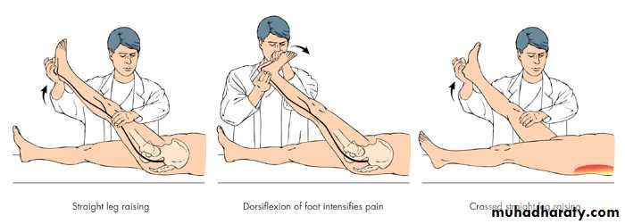 Back Pain