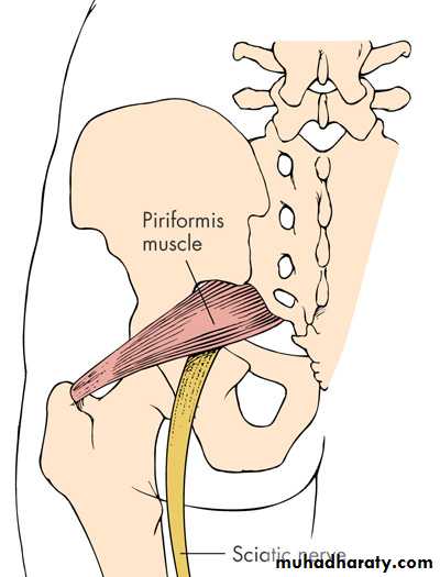 Back Pain