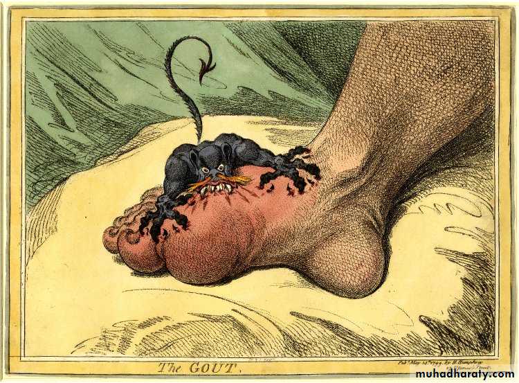 Gout