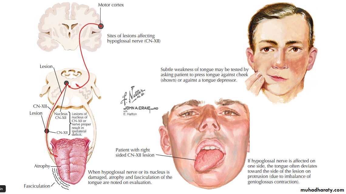 Cranial nerves disorders